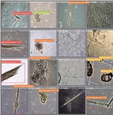 Cyanobacteria Identification 1